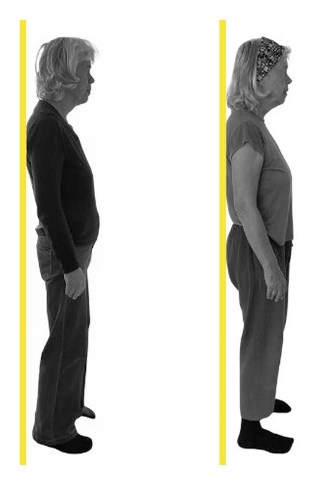 Before and after posture comparison, black and white, member of OsteoStrong Lagos after 8 months